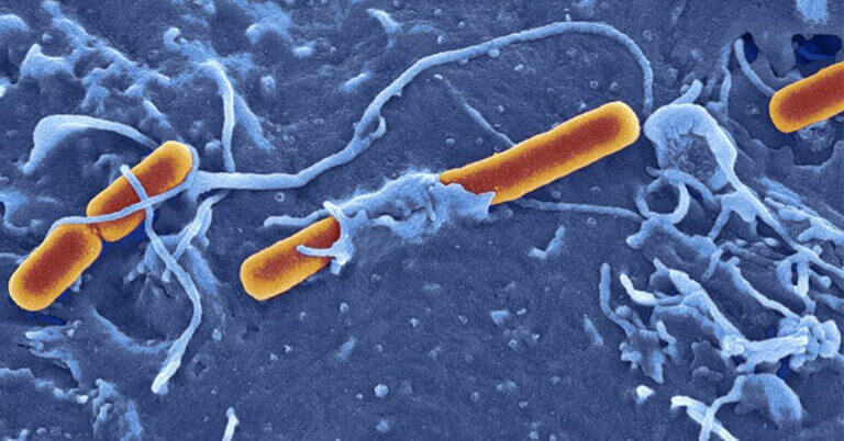 Microscopic image of Shingella pathogen